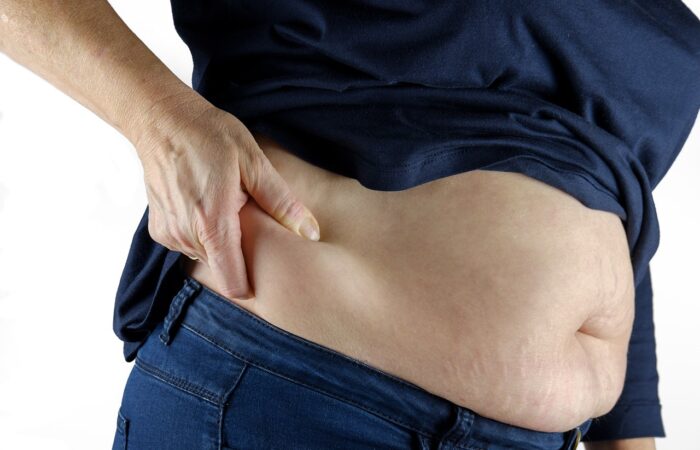 cryolipolyse ou lipocavitation